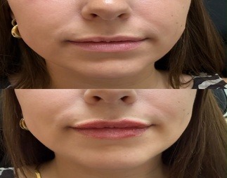 resized_Image_(5)