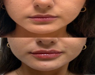 resized_Image_(7)